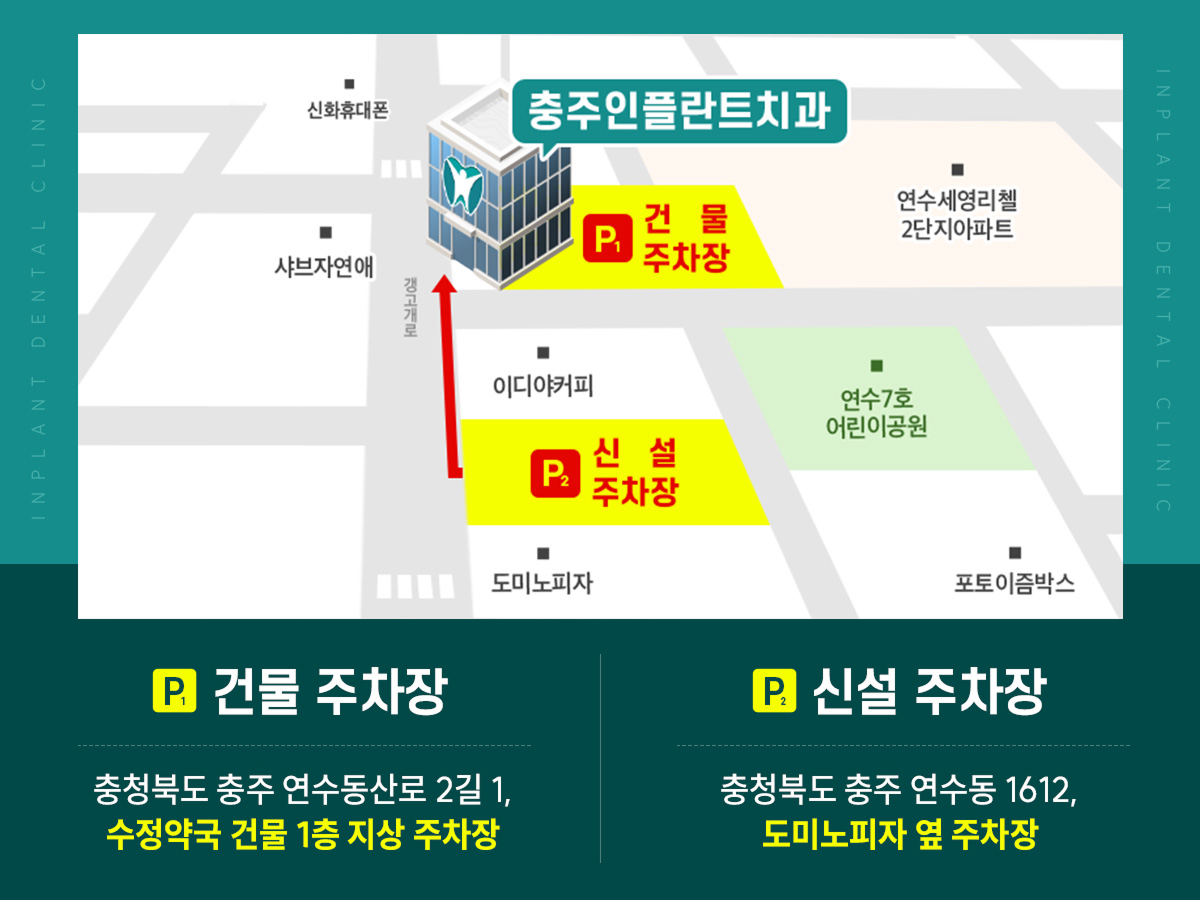 인플란트치과 주차 안내 - 건물 주차장 : 충청북도 충주 연수동산로 2길 1, 수정약국 건물 1층 지상 주차장 / 신설 주차장 : 충청북도 충주 연수동 1612, 도미노피자 옆 주차장