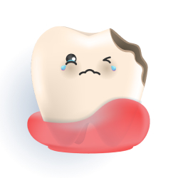 깨진치아