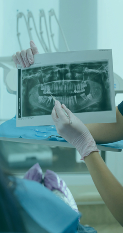 자연치아 보존원칙