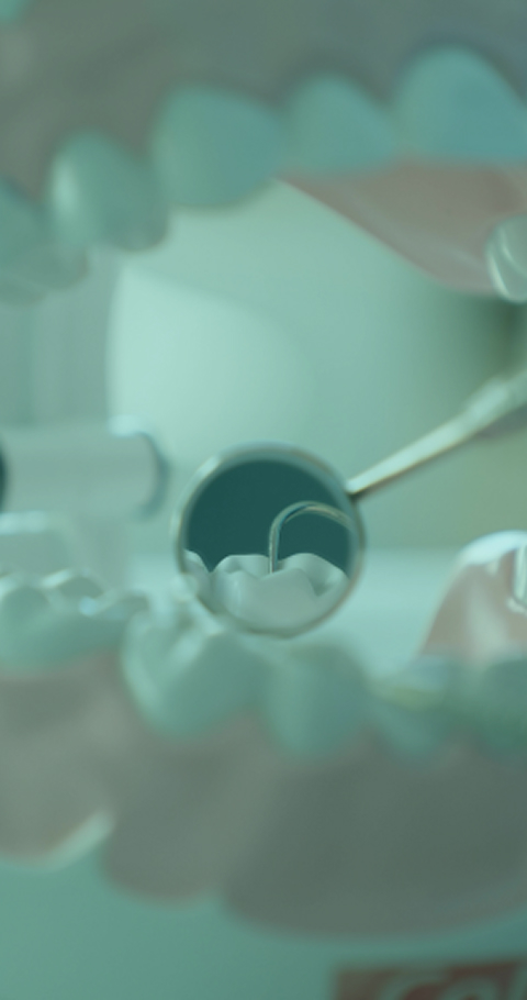 인플란트 충치치료